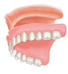 Full Denture