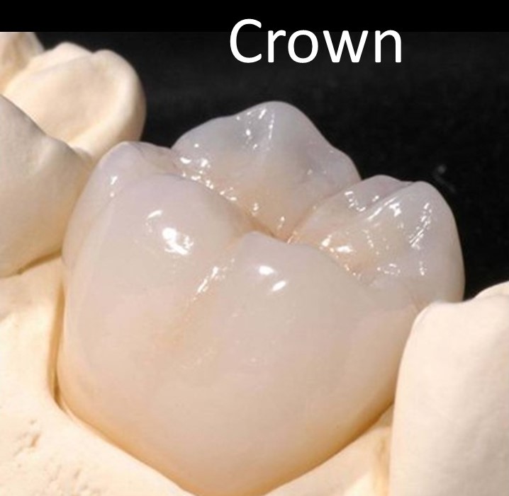 Crown