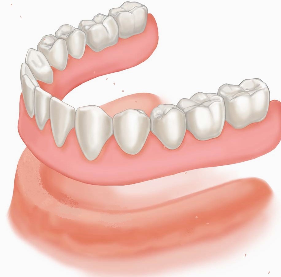 Denture