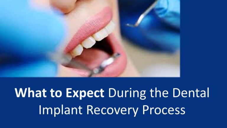 Dental implant recovery