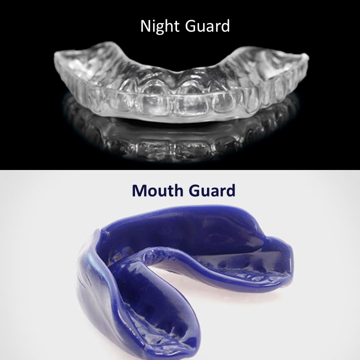 Nightguard and mouthguard side-by-side comparison